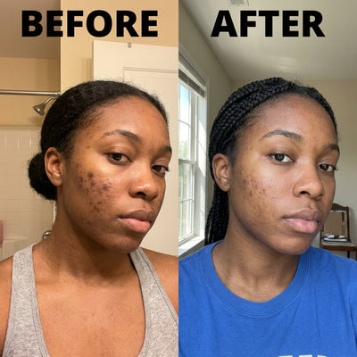 “The dryness around my nose improved.”